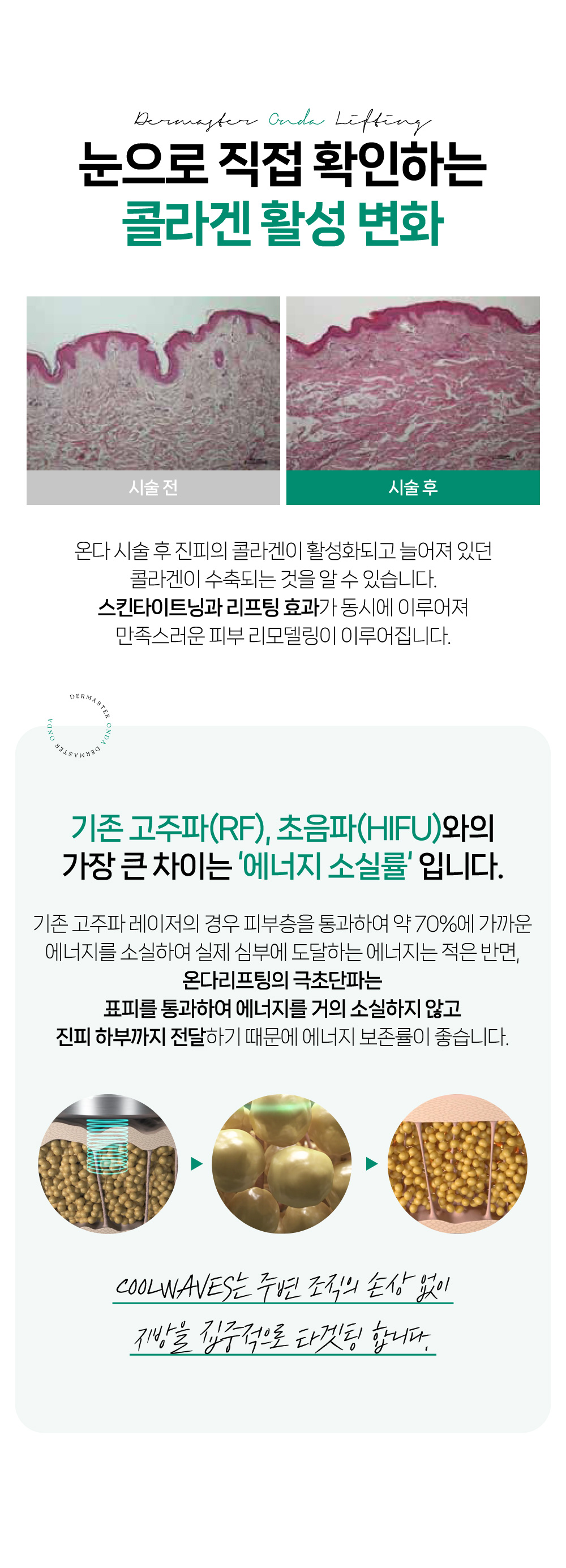 눈으로 직접 확인하는 콜라겐 활성 변화